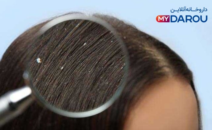 بهترین شامپو برای شوره و خارش سر و التهاب